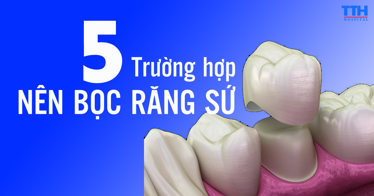 5 TRƯỜNG HỢP BẠN NÊN BỌC RĂNG SỨ?